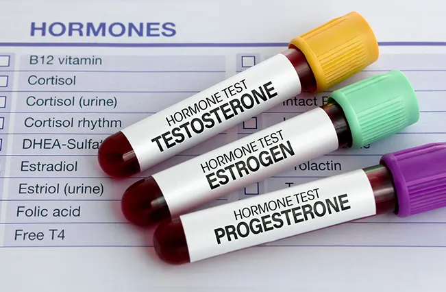 hormone-testing